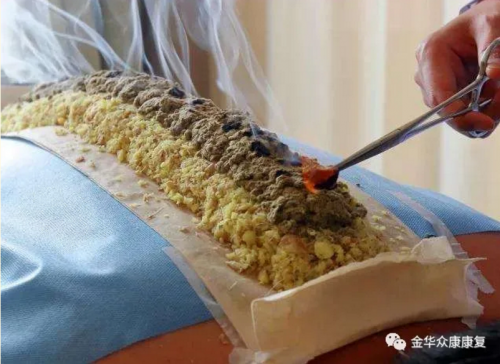 督脉灸的操作过程及适应人群