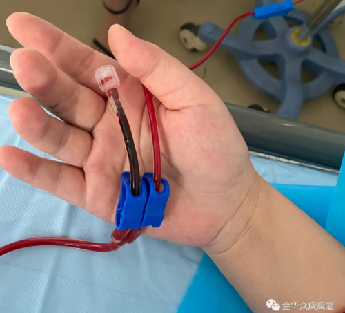 金华众康医院引进特色疗法：三氧自血疗法！