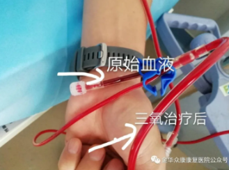 秋天脑血管疾病高发期，做对一件事就高枕无忧了